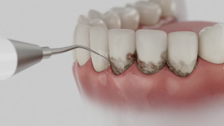 Reliable Dental Implants contractor in Tangerine, FL by Smile Center Dentistry
